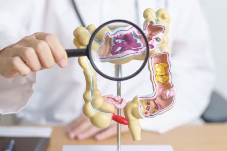 Why are more millennials getting colorectal cancer despite healthy lifestyles? Should you get a colonoscopy?