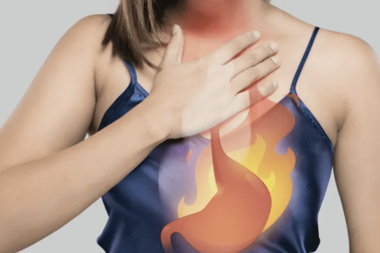 Can Acid Reflux Cause Cancer?