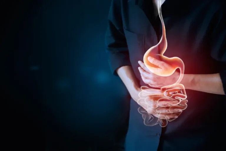 What Is The Difference Between GERD And Stomach Ulcer?